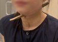 Ветка насквозь пробила шею девочки после прыжка с гаража в Ростове-на-Дону