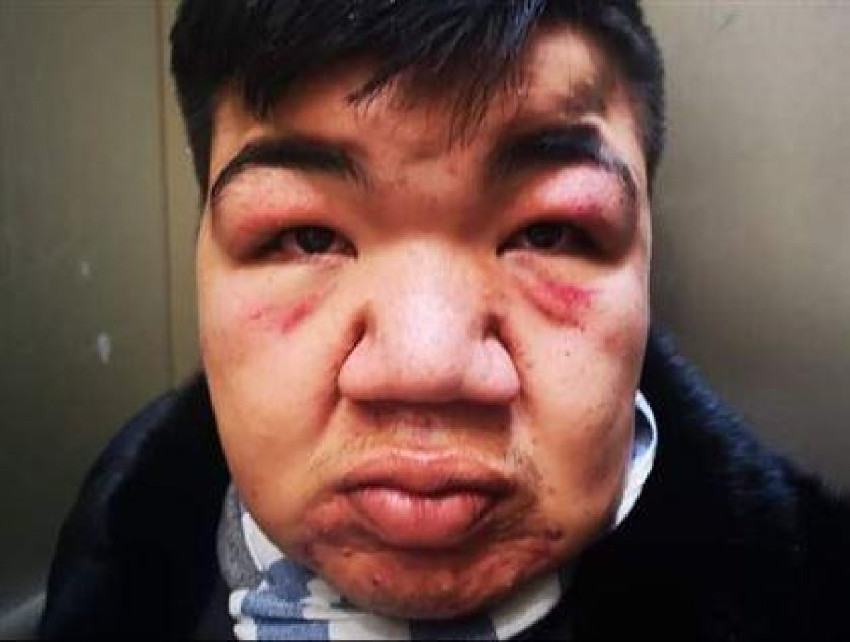 Сестра обидчика Крохи: Не усложняйте ситуацию