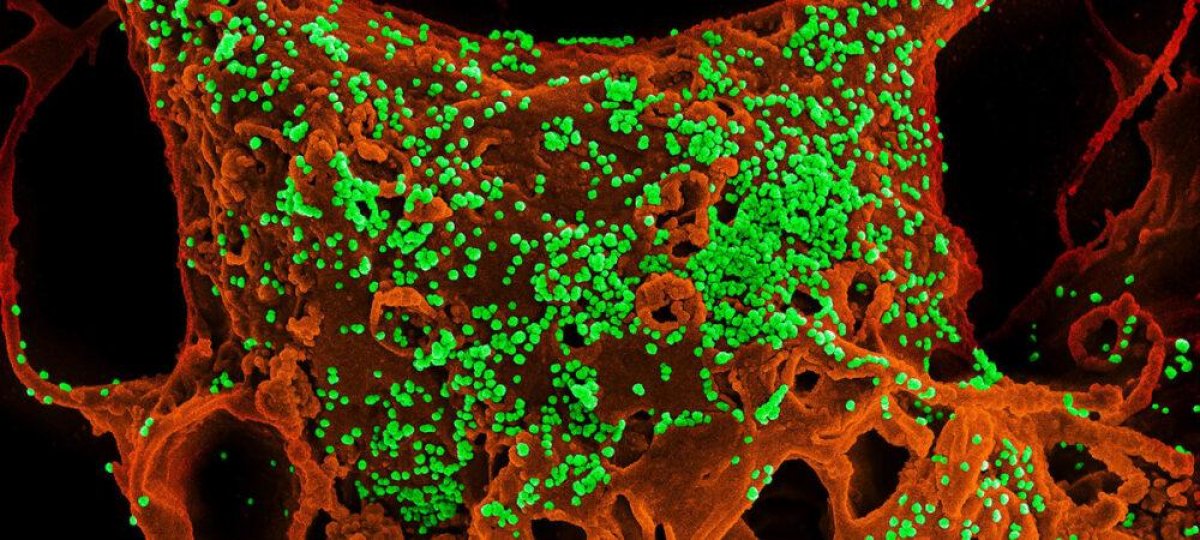 Названы препараты, способные победить коронавирус
