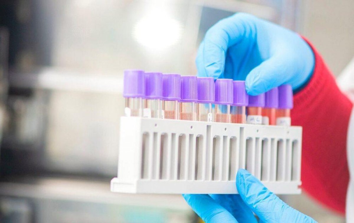 465 заболевших коронавирусом выявили в Казахстане за сутки