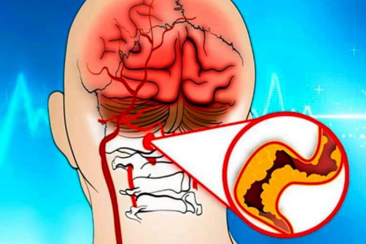 Что делать при болях в голове и шуме в ушах – советы врача