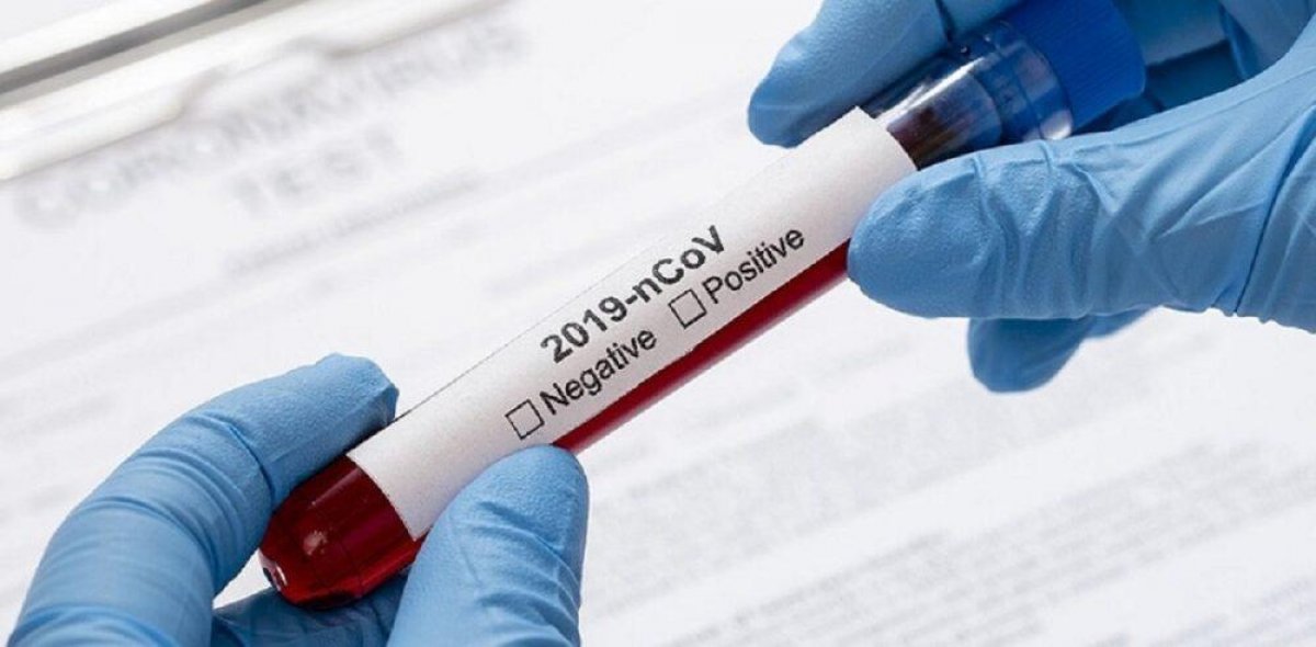 За сутки в Казахстане выявлено 795 заболевших коронавирусом