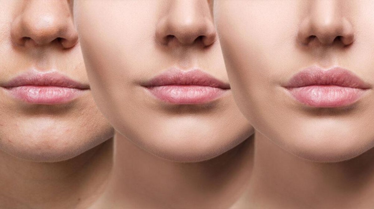 Как у Анджелины Джоли: как увеличить губы в домашних условиях