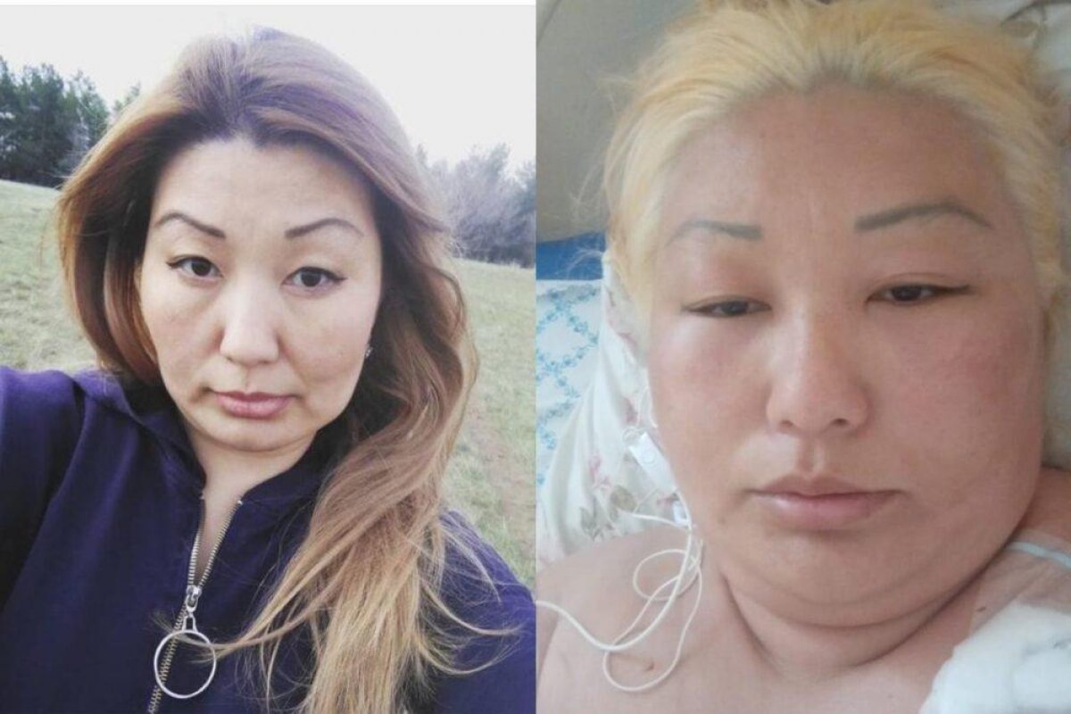 В реанимации оказалась жительница Уральска после окрашивания волос в салоне