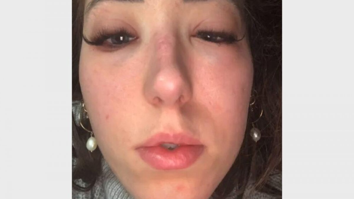 Блогер чуть не уничтожила себе глаза клеем для ресниц. Что было дальше