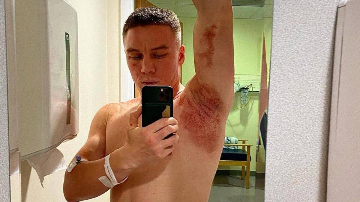 Казахстанского боксера облили кислотой в Англии