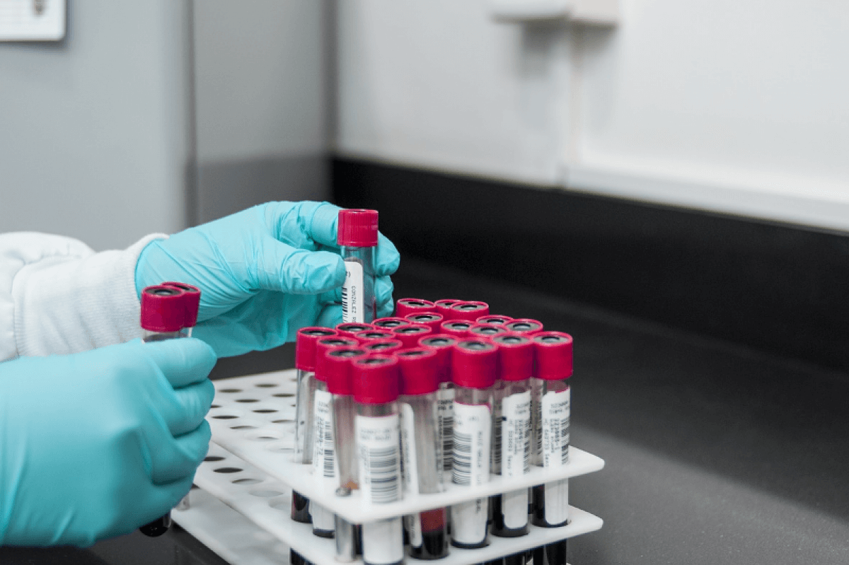 В Казахстане незначительный спад новых случаев COVID-19