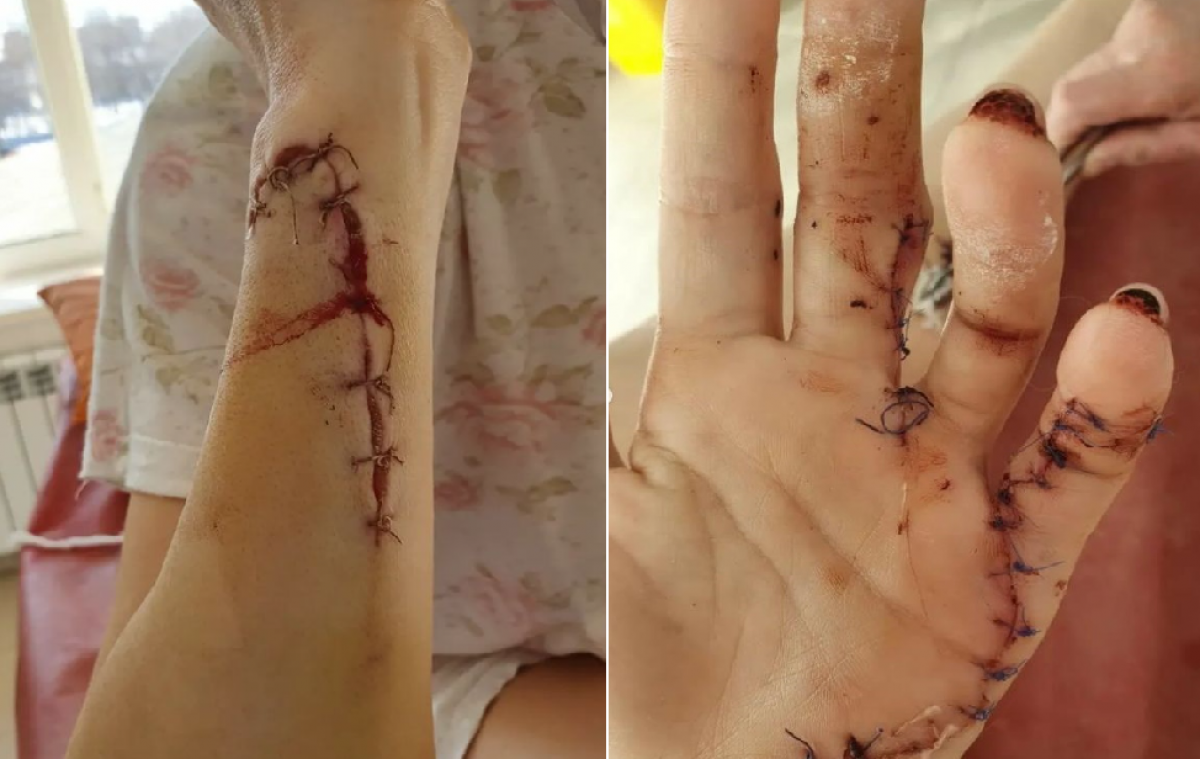 "Он шел ее убивать": мужчина исполосовал ножом бывшую супругу в Атырау