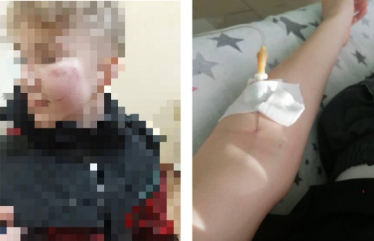 В Экибастузе подросток попал в больницу после избиения в школе
