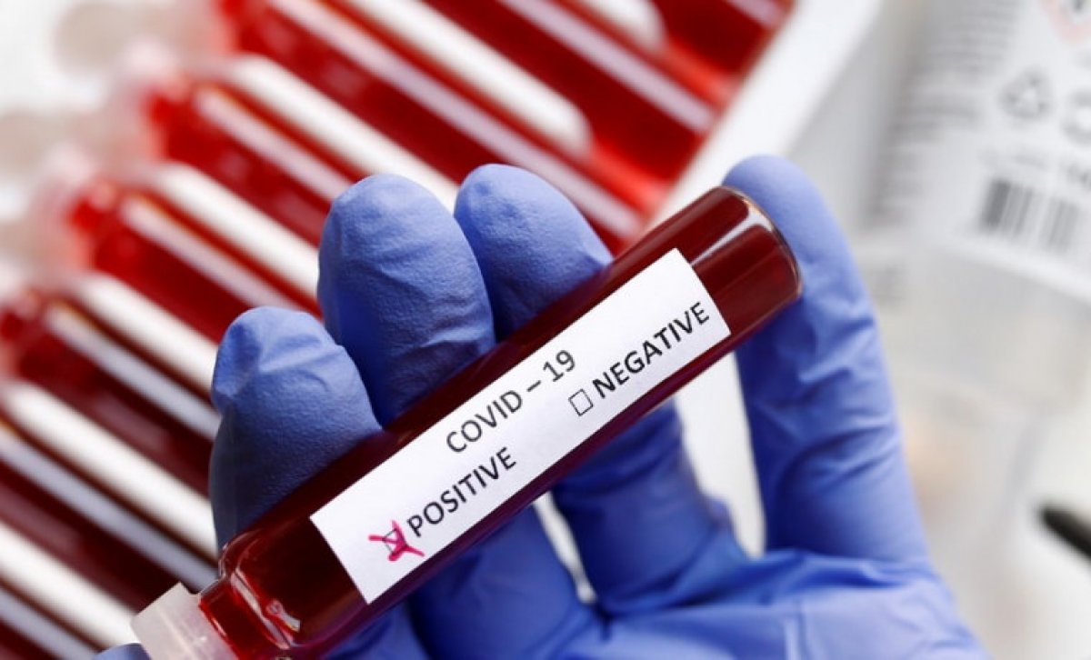 Заболевших коронавирусом выявили в пяти регионах Казахстана