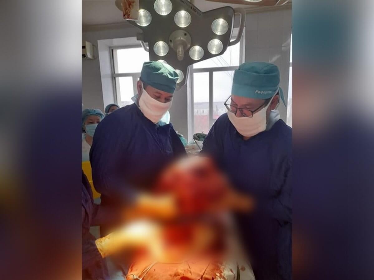 15-килограммовую опухоль удалили у жителя Атырау