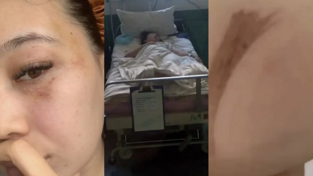 Кызылординка осталась инвалидом после конфликта с мужем, но дело не дошло до суда