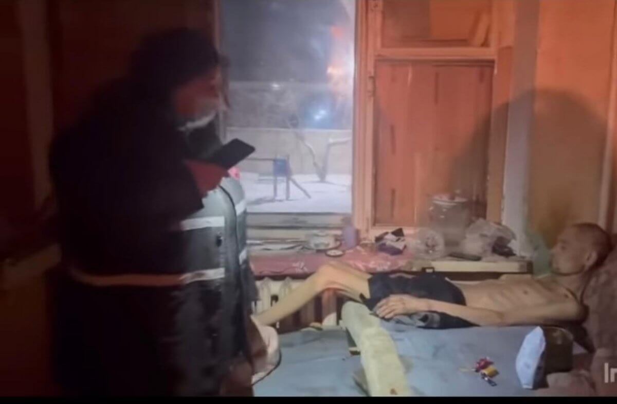 На учете в СПИД-центре, агрессивен: что известно о гниющем заживо павлодарце