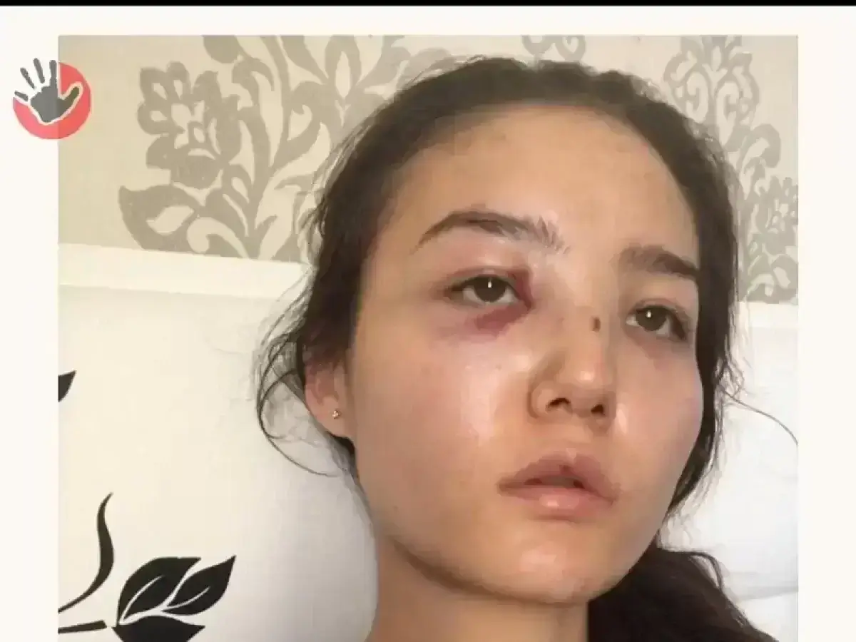 Дипломат избивал жену: Карина Мамаш поделилась шокирующим роликом