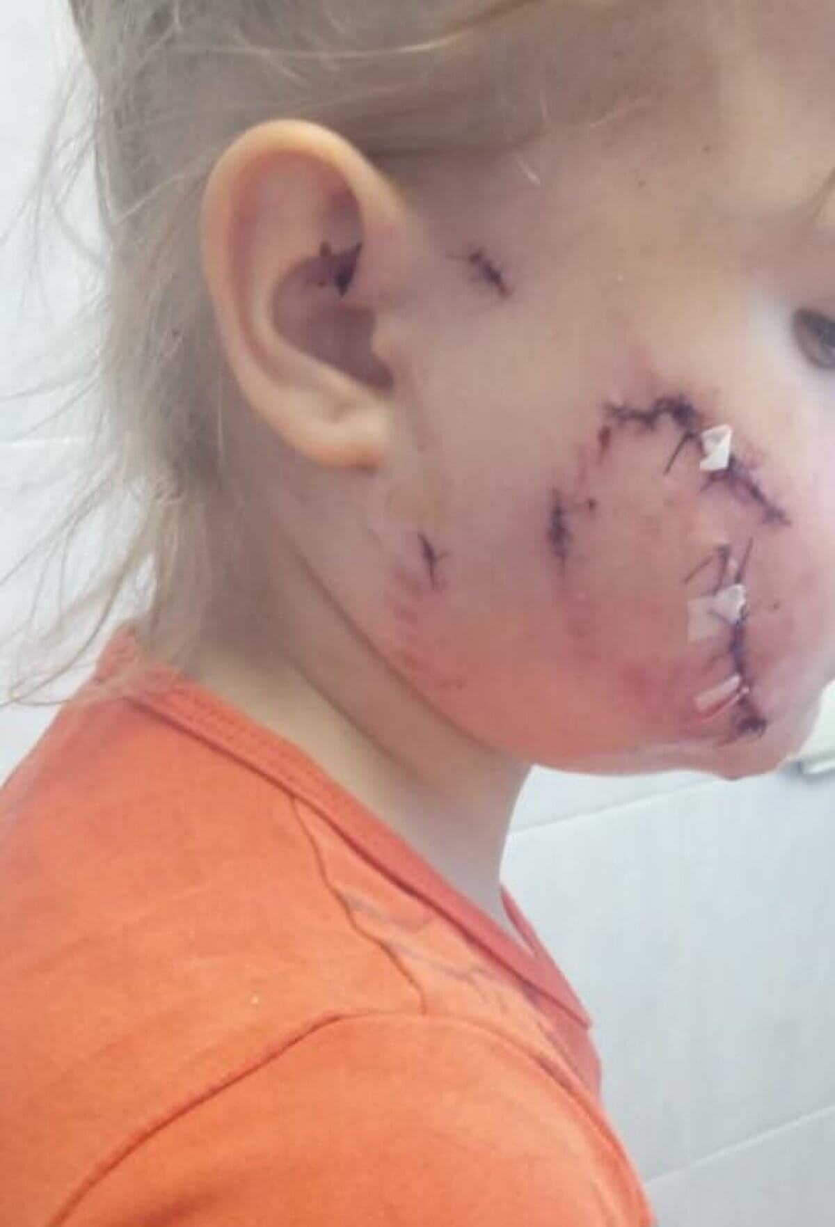 Собака покусала лицо 4-летней девочки в Караганде