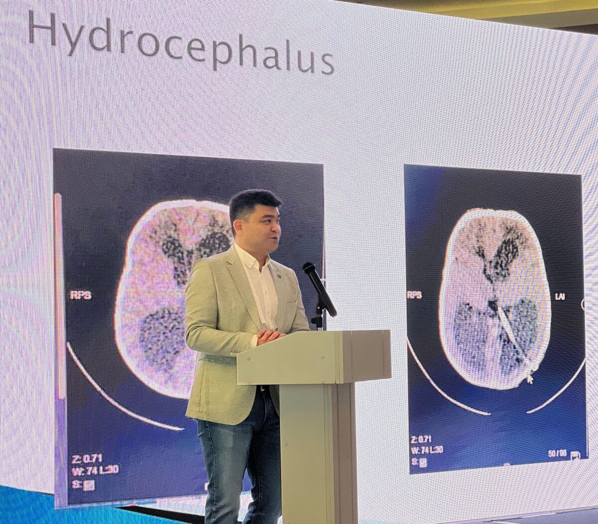 Казахстанские и китайские нейрохирурги объединяют усилия