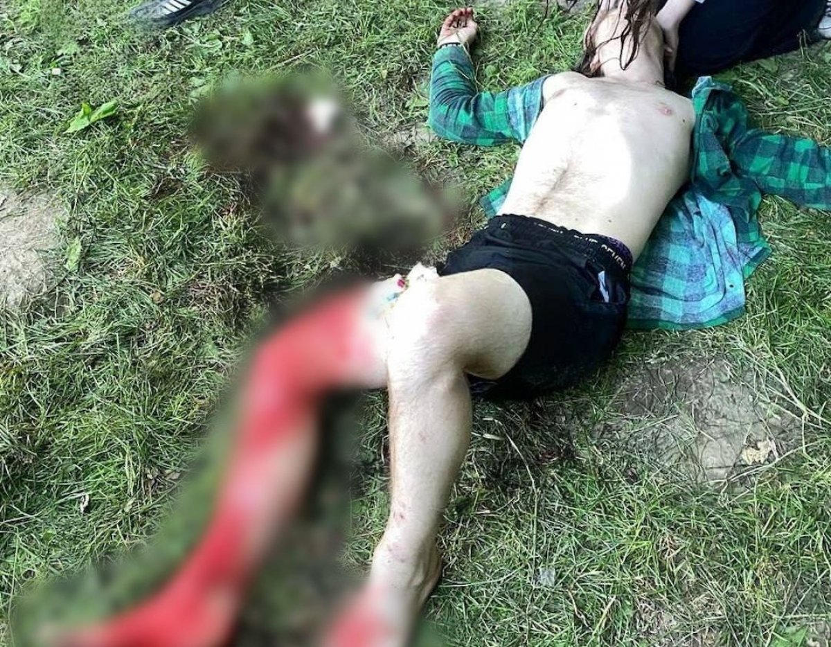 Мужчина изрезал подростка в Нижнем Новгороде