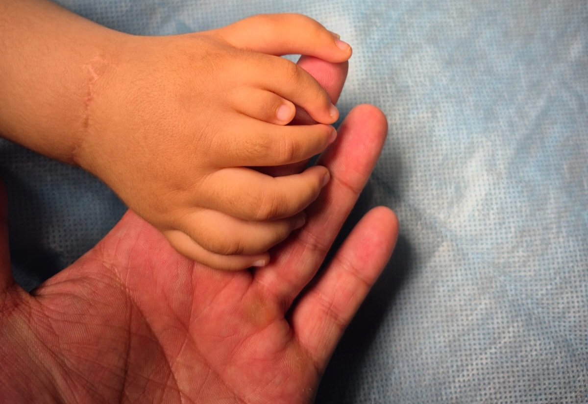 Пять пальцев вместо восьми: как детям Алматы возвращают надежду