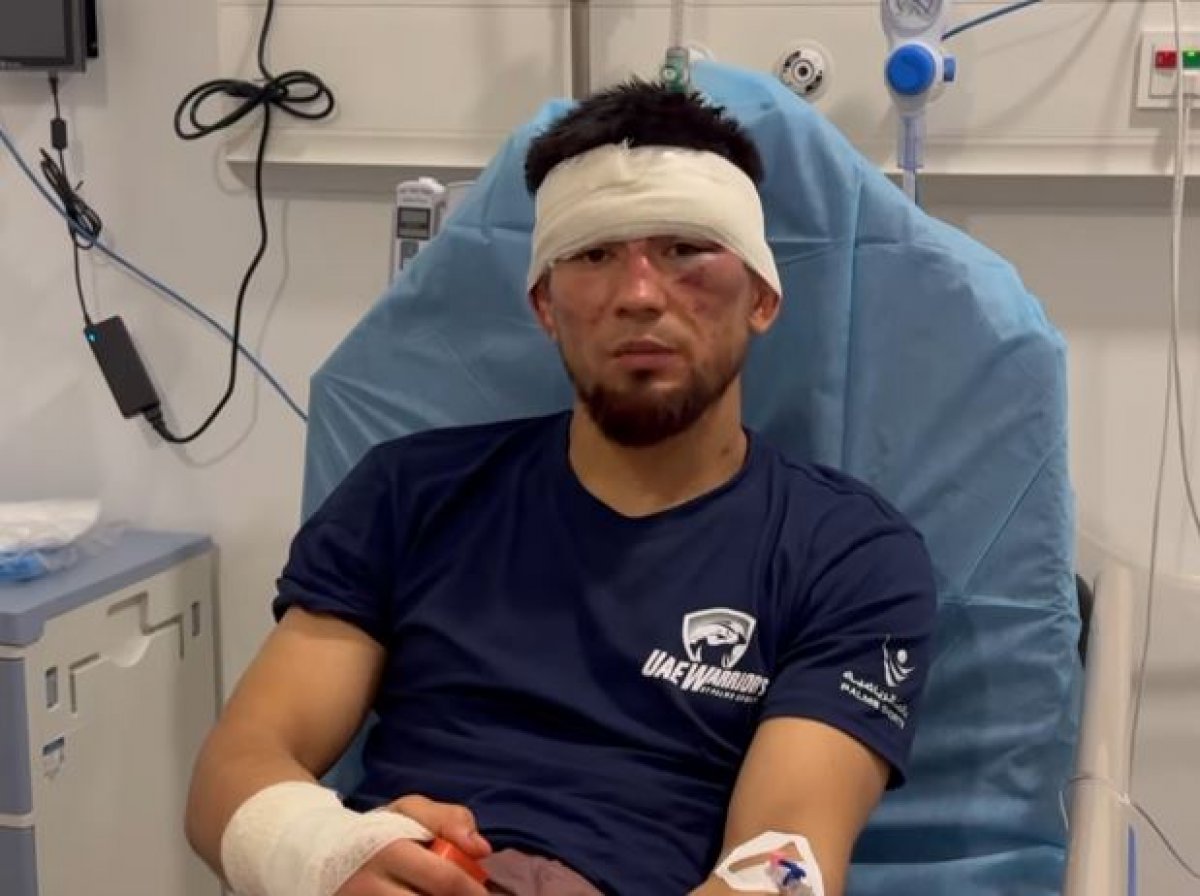 Казахстанский боец бился на ринге со сломанной рукой