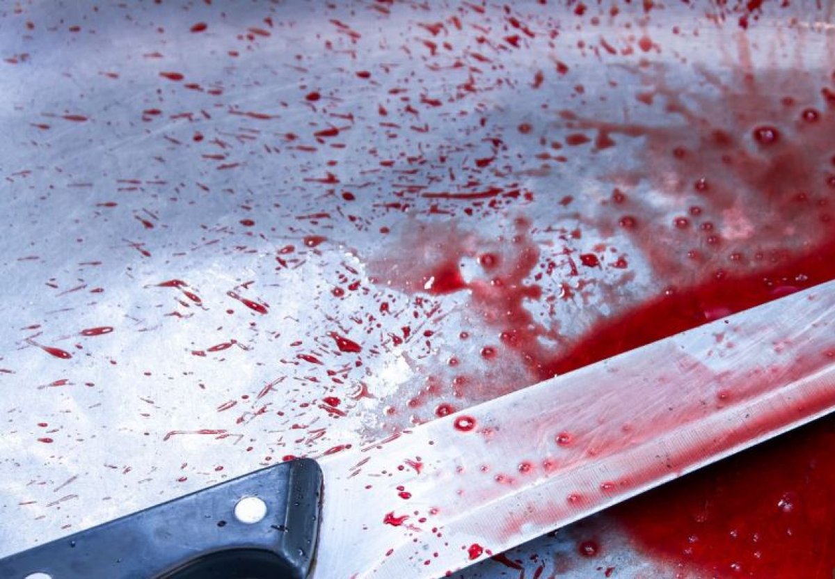 32 ножевых ранения получил прихожанин в мечети Баку