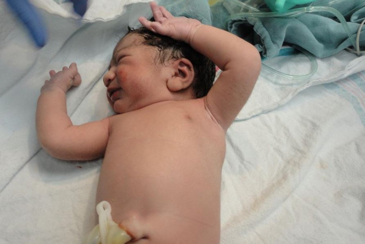 Отец перегрыз пуповину, и младенец начал истекать кровью