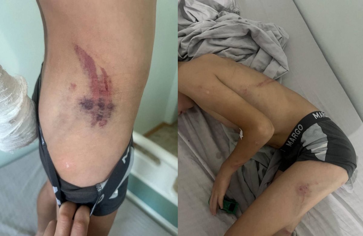 Жестокое избиение ребенка в Балхаше: появились шокирующие подробности