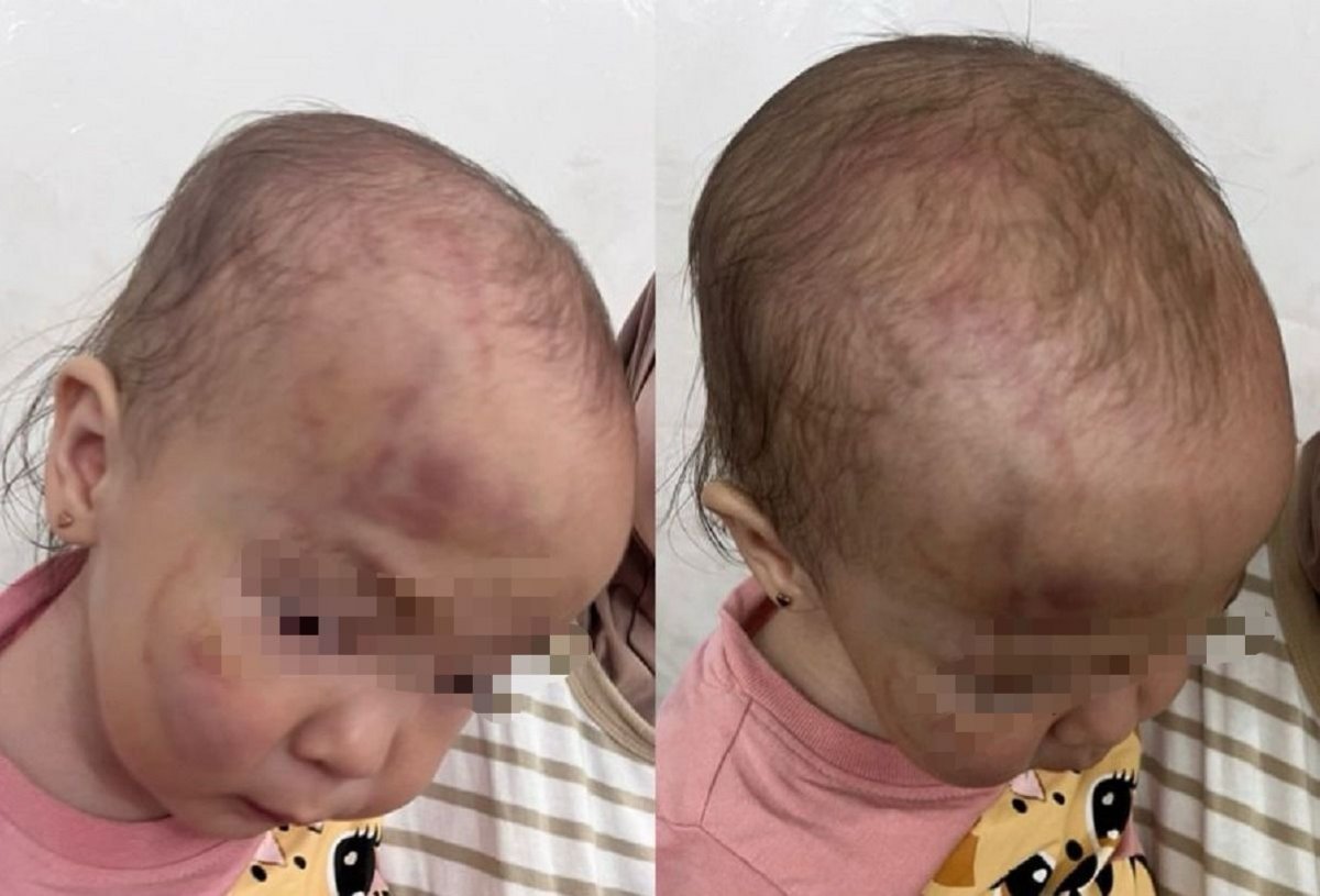 Девочка избила одногруппницу до кровоподтеков в детском саду Актау