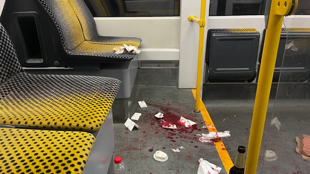 Мужчина спасал девушку и получил удар ножом по лицу