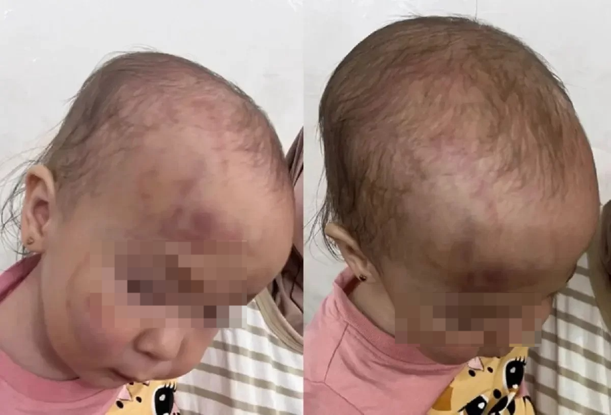 Мать избитой девочки из Актау обвинила следствие в попытке замять дело