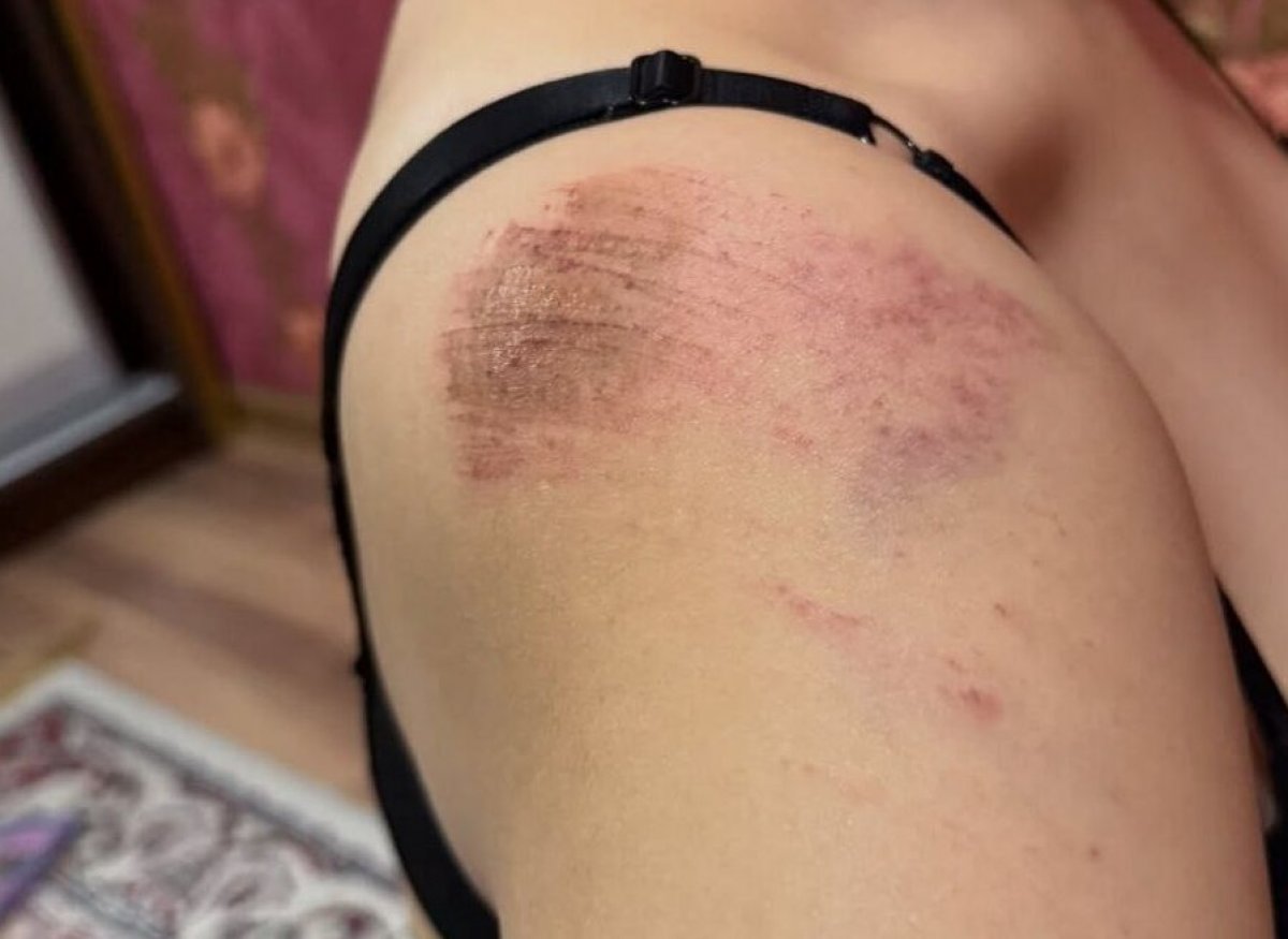 Блогера вывезли на кладбище и избили в Атырау