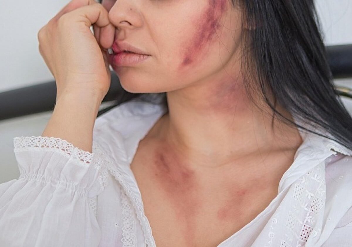 Избил сожительницу до перелома челюсти: суд отправил шымкентца за решетку