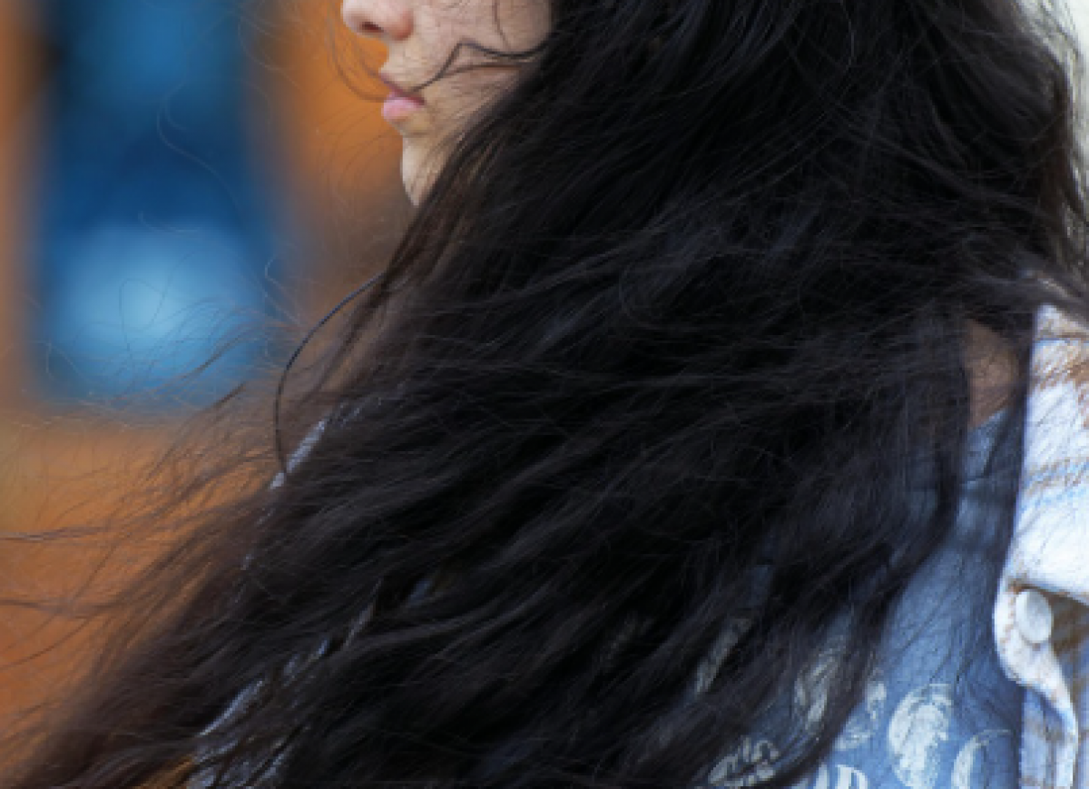 Ком волос весом 1,4 кг обнаружен в желудке девушки из Узбекистана