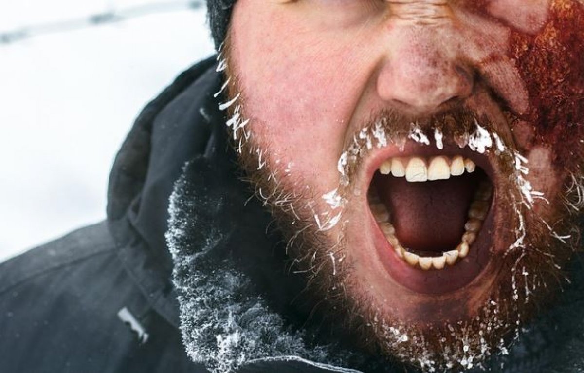 Люди ушли под асфальт и получили ожоги в России