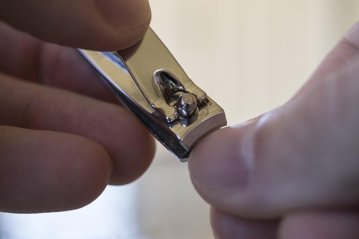 Что скрывается за ломкостью ногтей и как помочь