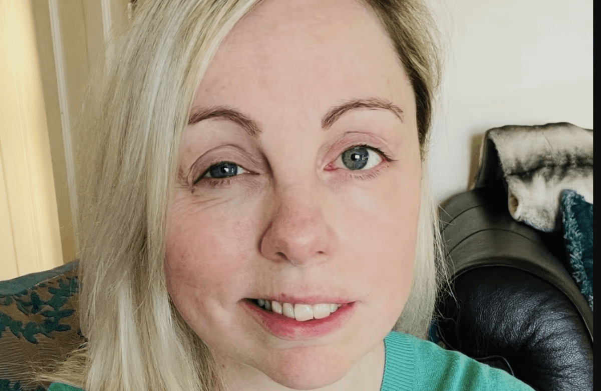 Женщина проснулась с перекошенным лицом накануне долгожданной свадьбы