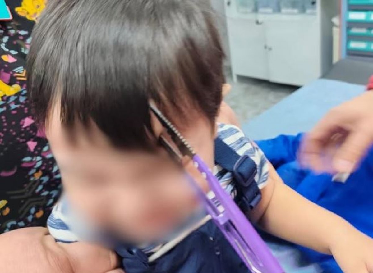 Мальчик пробил лоб ножницами при падении в Алматы