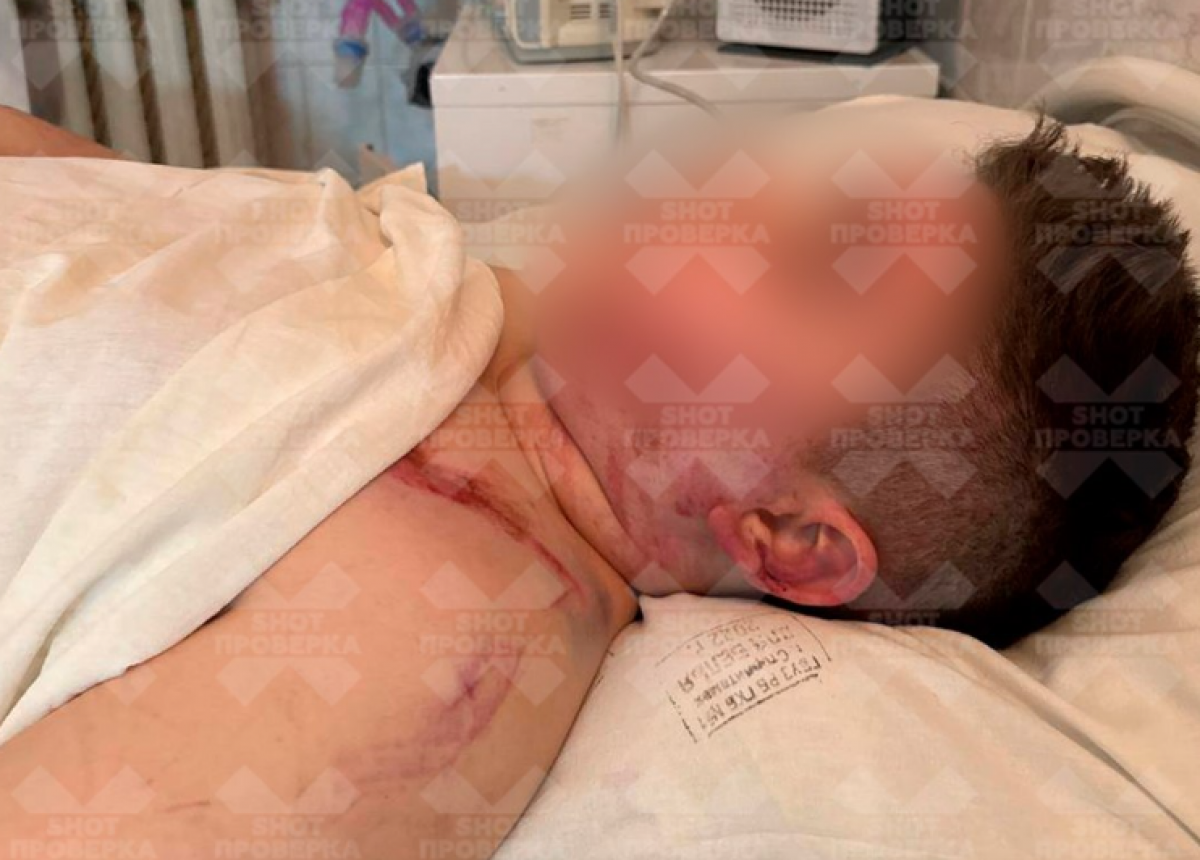 Ребенок лишился пальцев и получил перелом позвоночника на аттракционе в России