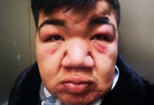 Известного клоуна с редким диагнозом жестоко избили в алматинском общежитии