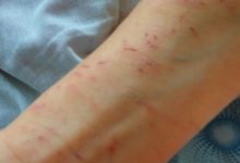 В избиении шестилетнего карагандинца подозревают его мать и отчима