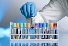 Биртанов прокомментировал "откаты" врачей частным лабораториям