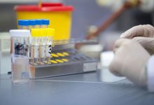 Экспресс-тесты для выявления коронавируса у астанчан будут проведены в ближайшие две недели