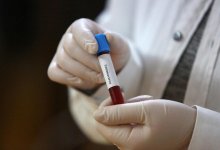 Сразу восемь новых случаев коронавируса выявили в Казахстане