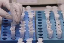 Еще четыре случая заражения коронавирусом выявлены в регионах Казахстана