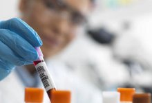 101-летняя женщина вылечилась от коронавируса в Нидерландах