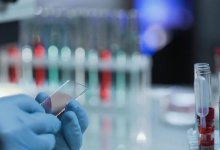 Пандемия коронавируса продлится до 2022 года: Прогноз экспертов