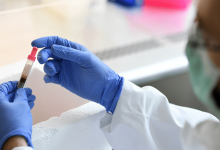 Во Франции рассказали, когда появится вакцина от коронавируса