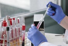 Казахстанские ученые начали доклинические испытания вакцины против COVID-19