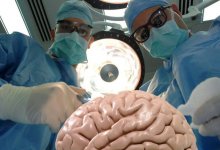 В Казахстане родители решили вылечить гомосексуальность сына с помощью операции на мозге