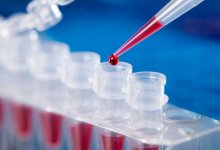 Чиновников тестируют на коронавирус на равных правах с казахстанцами – Цой