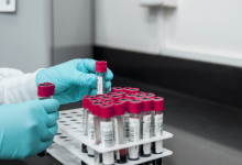 ВОЗ и главный инфекционист США требуют проверить российскую вакцину от коронавируса